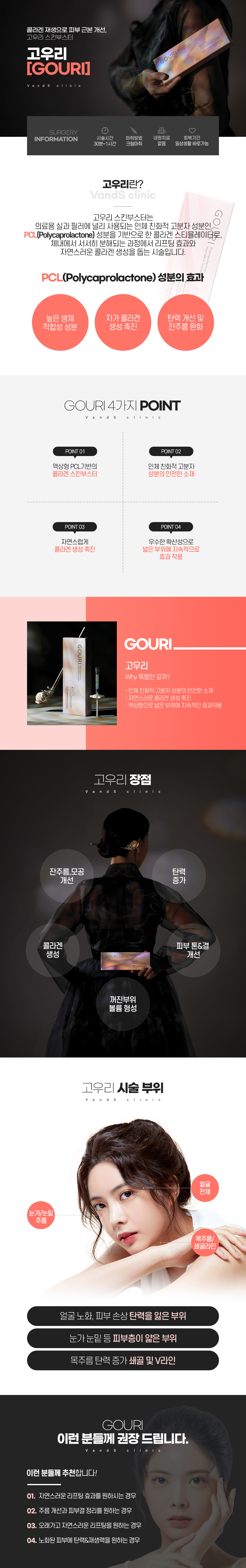 고우리 시술안내 이미지1