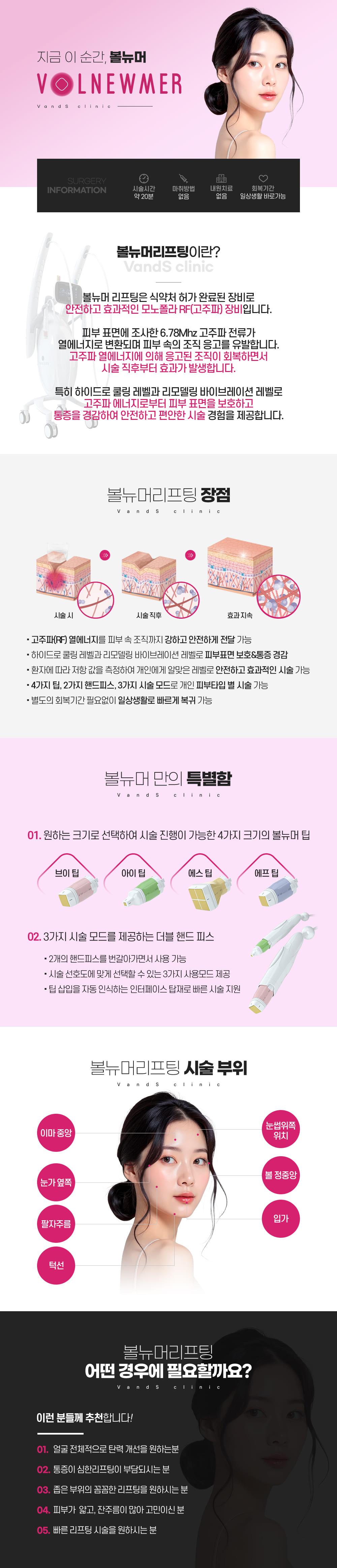볼뉴머 시술안내 이미지1